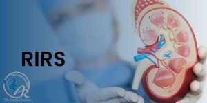 عمل جراحی ریرس