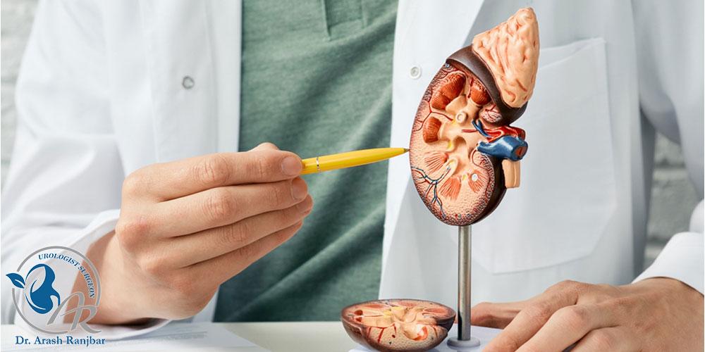 بهترین دکتر سنگ