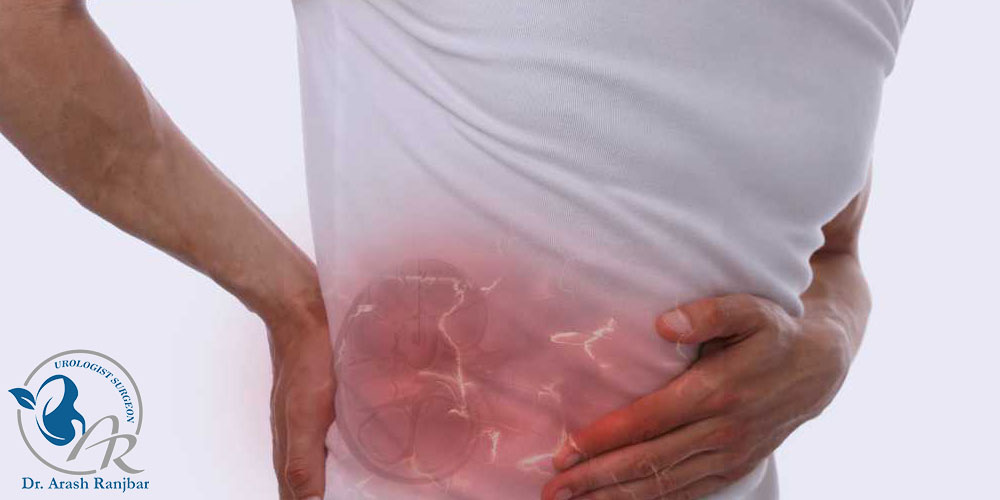 علت درد پس از سنگ‌ شکن کلیه