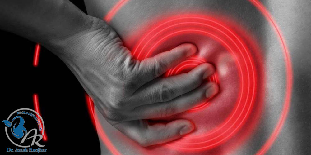 علت درد پس از سنگ‌ شکن کلیه