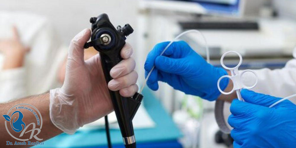 سیستوسکوپی و مراقبتهای بعد از آن