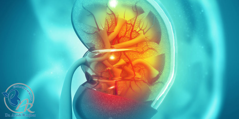 سنگ شکنی کلیه با لیزر