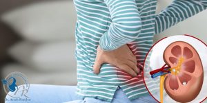 سنگ شکنی کلیه با لیزر