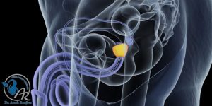 انزال خشک چیست